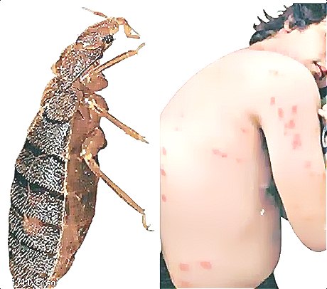 深圳殺蟲公司教您如何滅臭蟲 (57).jpg