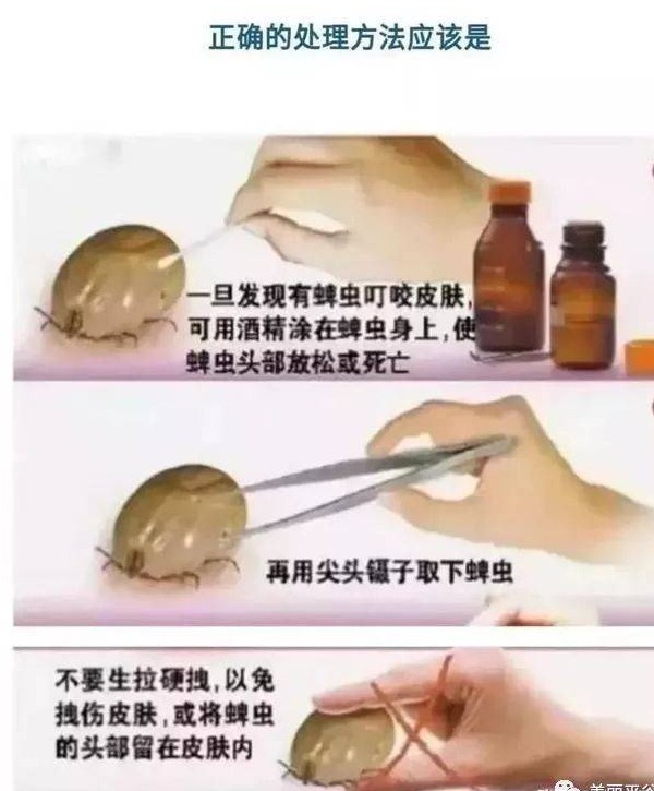 深圳殺蟲公司怎樣快速去除跳蚤和蜱蟲等寄生蟲？_6 (9).jpeg