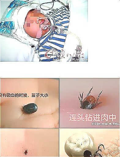 深圳殺蟲公司教您恙蟲病的預防與控制 (29).jpeg